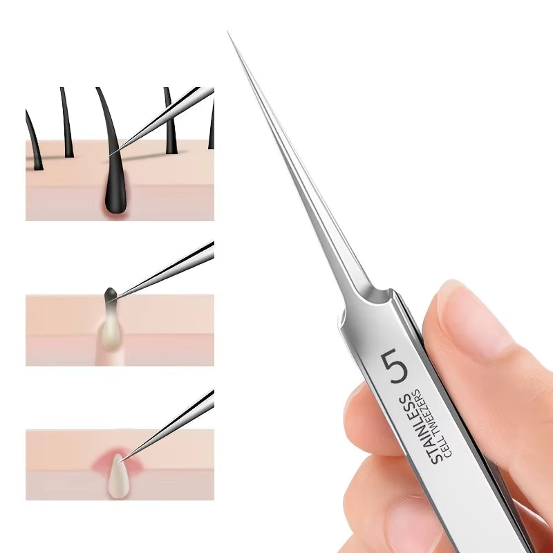 Blackhead Removal Tweezers Stainless Steel Tools - Effective Comedones Extractor, Whiteheads Removal Deep Cleansing Tools